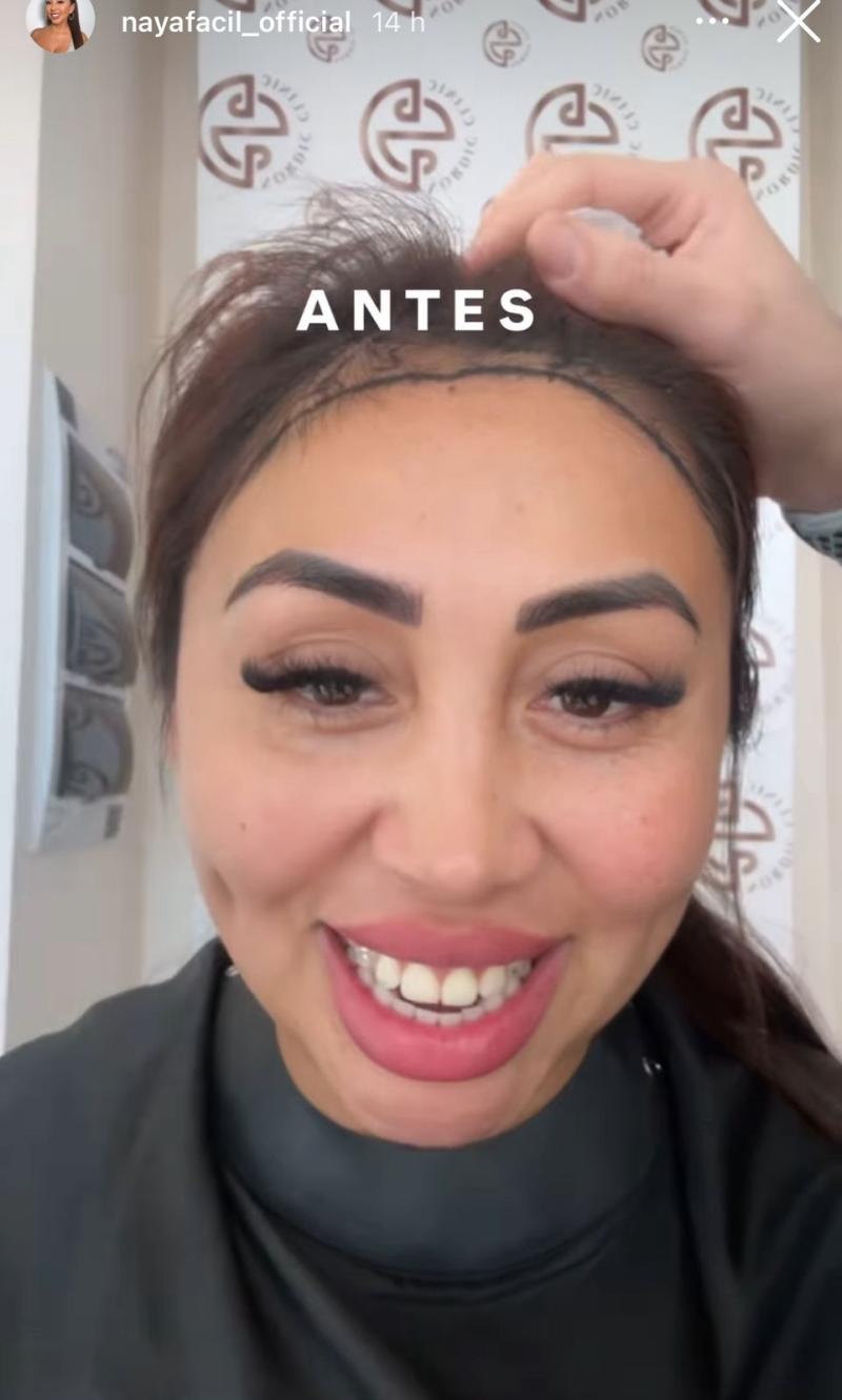 Así se veía Naya Fácil antes del injerto - Instagram