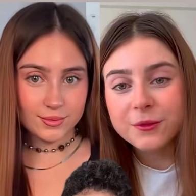 Revelan que Roro se operó la nariz - Captura