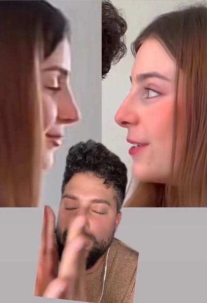 Roro se operó la nariz - Captura