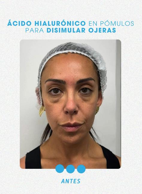 Así lucía Mariela Sotomayor antes de procedimiento estético - Instagram