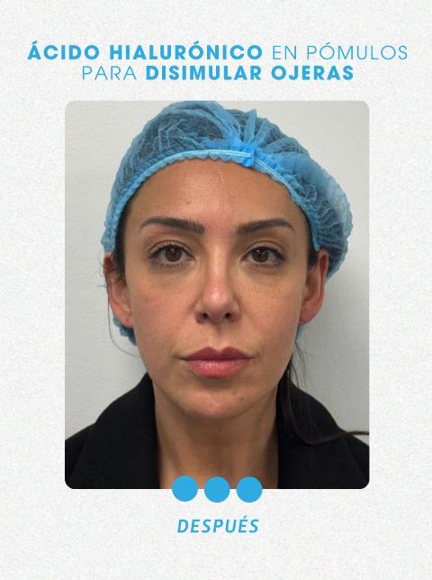 Así quedó Mariela Sotomayor después de procedimiento estético - Instagram