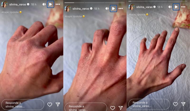 Silvina Varas - Instagram.