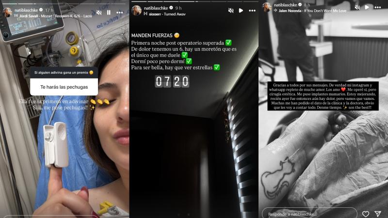 Detalles de la operación de la influencer Natalia Blaschke - Instagram