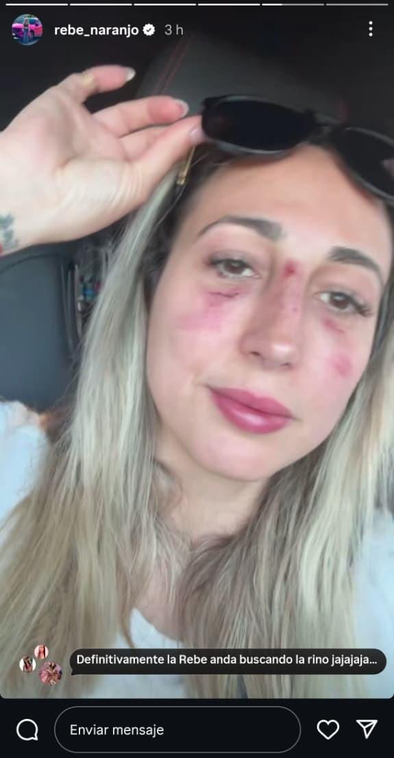 Accidente de Rebeca Naranjo - Instagram