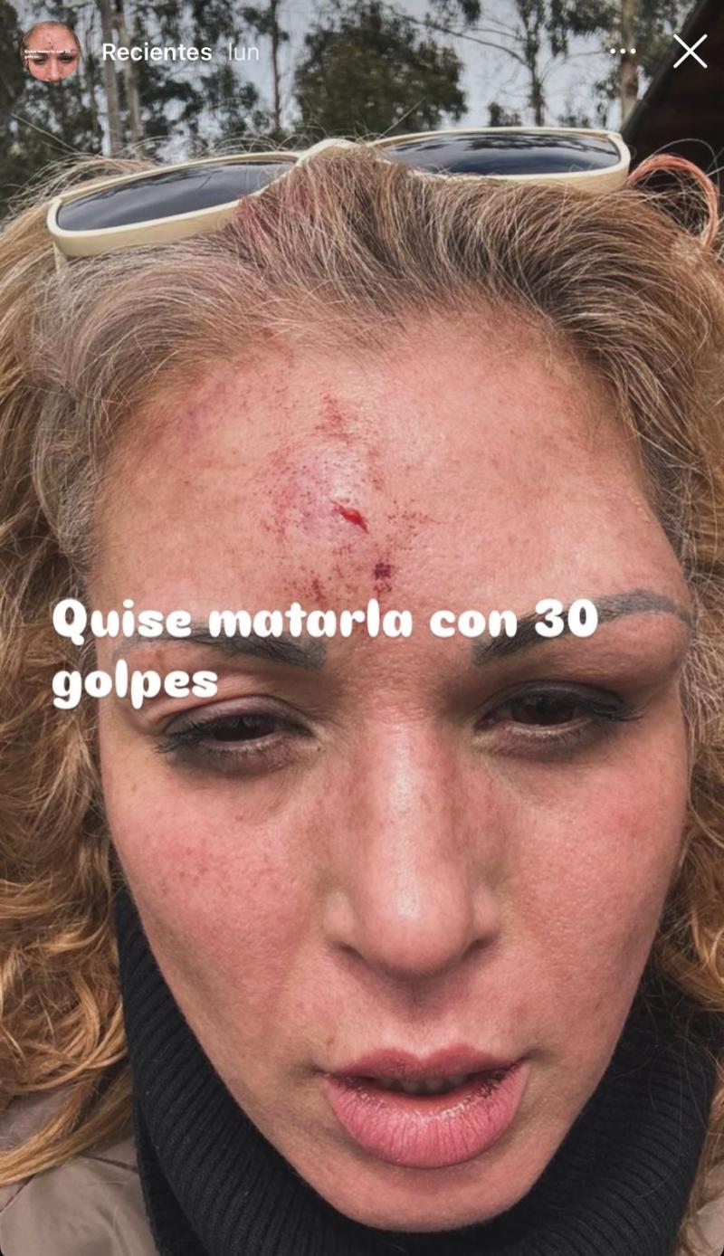 Fotografía de los golpes de Ariela Medeiros | Instagram