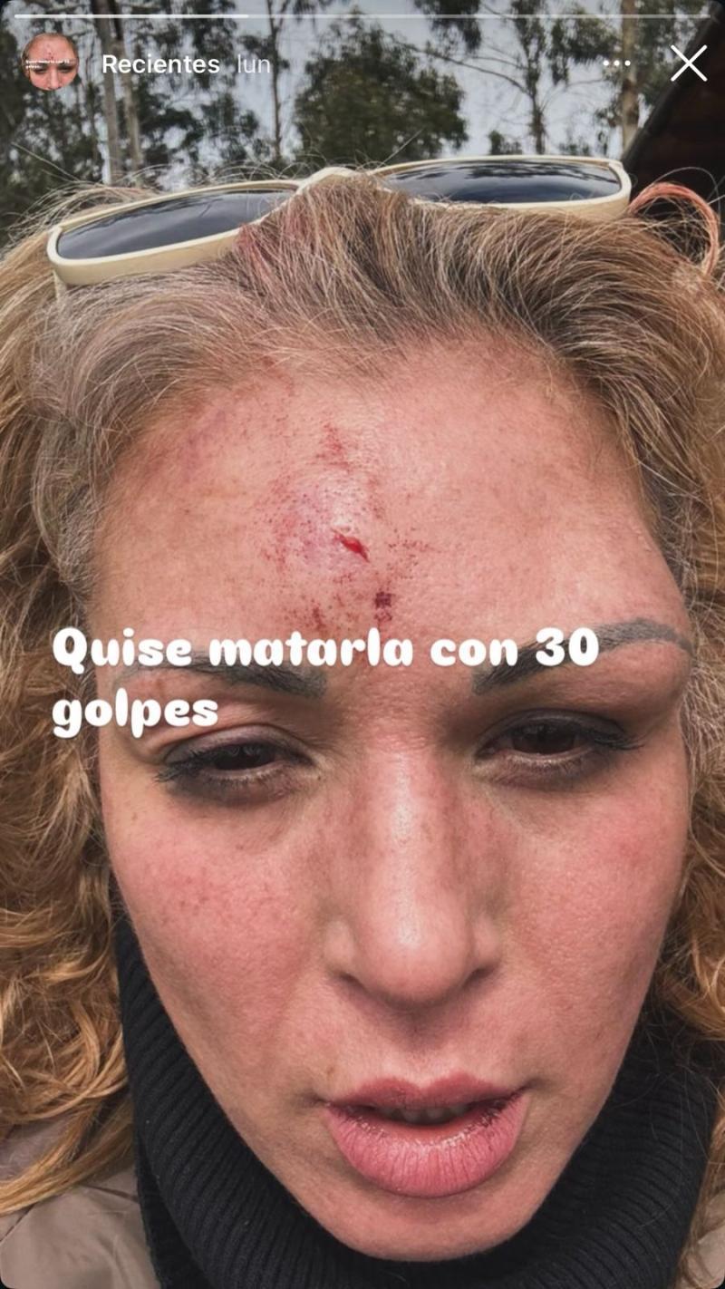 Agresiones a Ariela Medeiros.