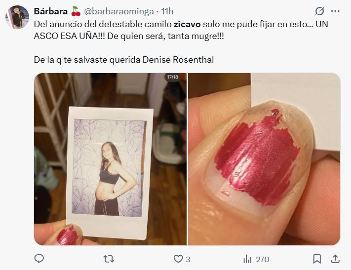 Comentarios en redes sociales | X