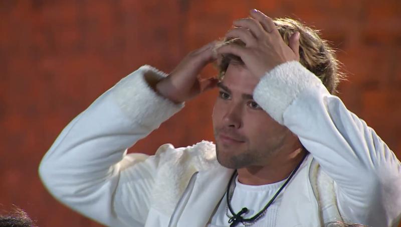 Jota contó que se sometió a extraña cirugía capilar