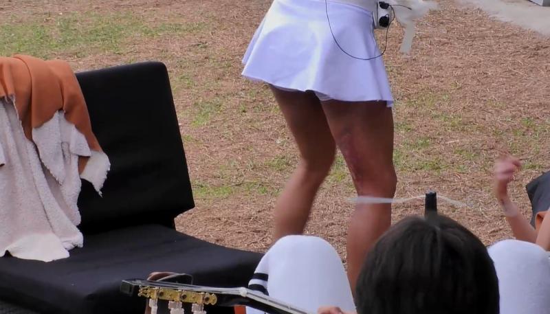 Así quedó la pierna de Evelyn Ortiz