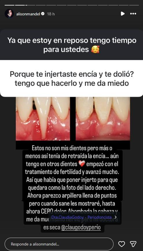 Alison Mandel | Instagram