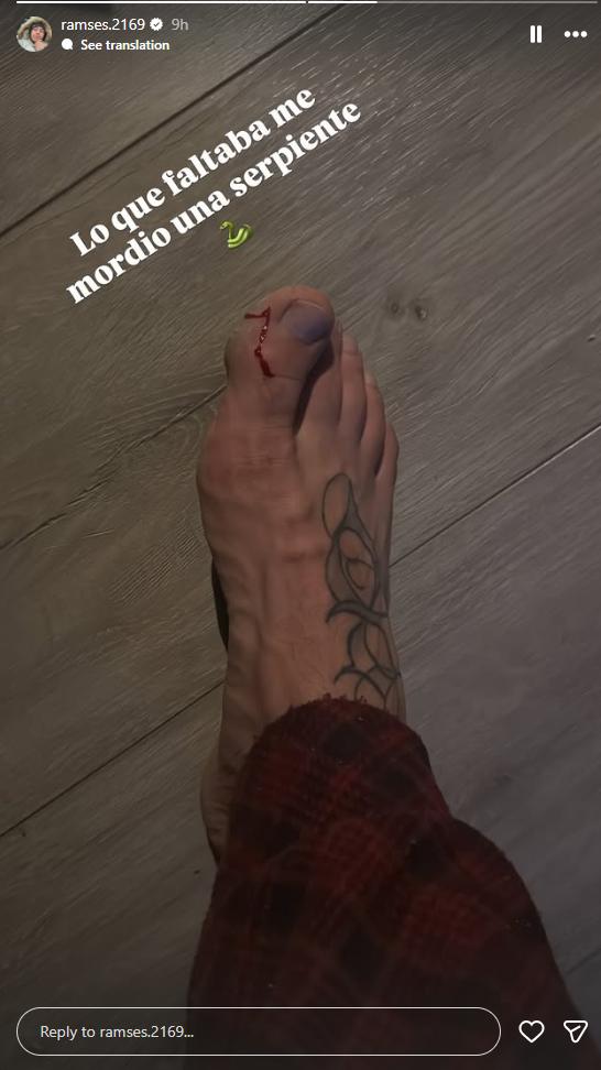 Lucas Lama y la foto de su accidente | Instagram