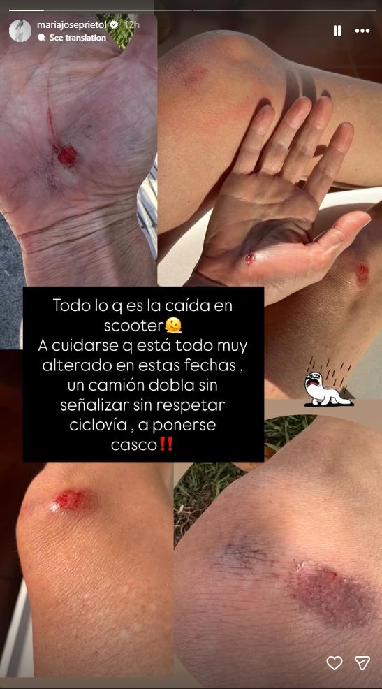 María José Prieto y su accidente de tránsito | Instagram