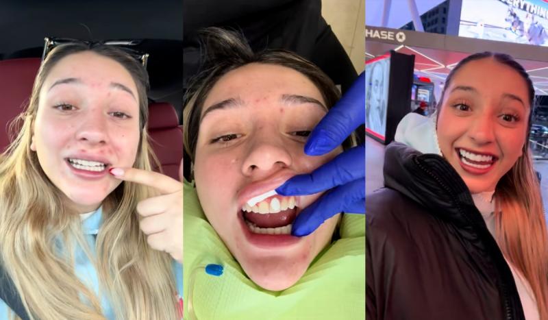 Antes y después de Carlita | TikTok