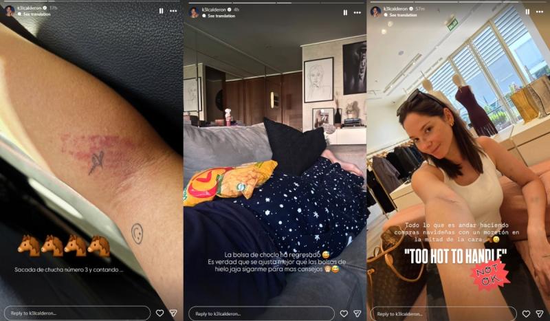 Kel Calderón con lesiones en su cuerpo | Instagram