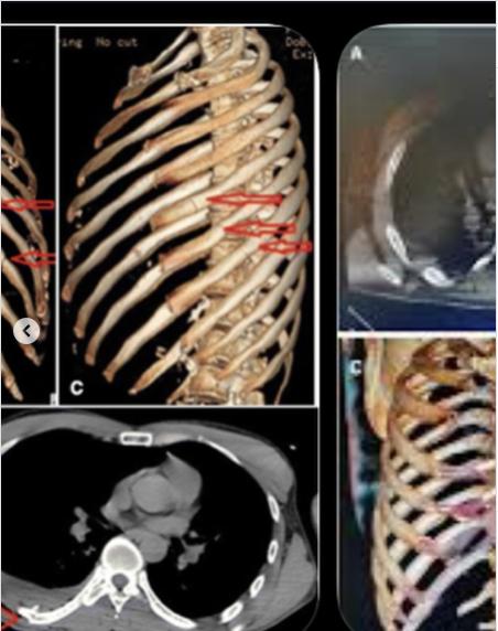 Corey Harrison | Instagram