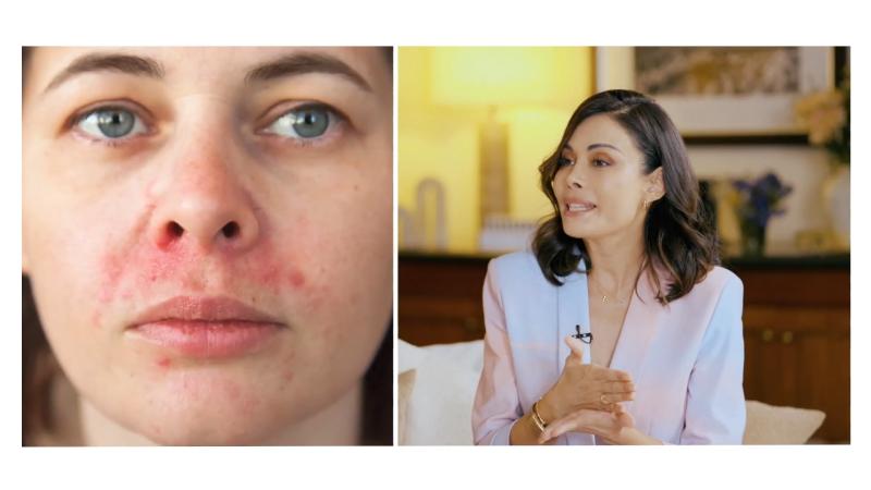 Lorna Velázquez, dermatóloga y directora médica de Clínica Neo. Créditos: 13C YouTube