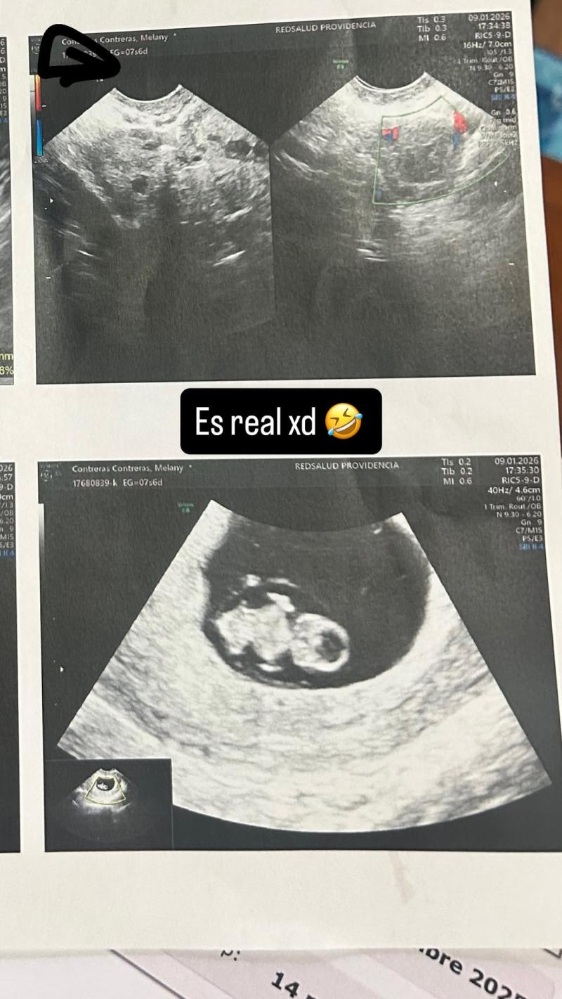 Melany Contreras confirmó nuevo embarazo - Instagram