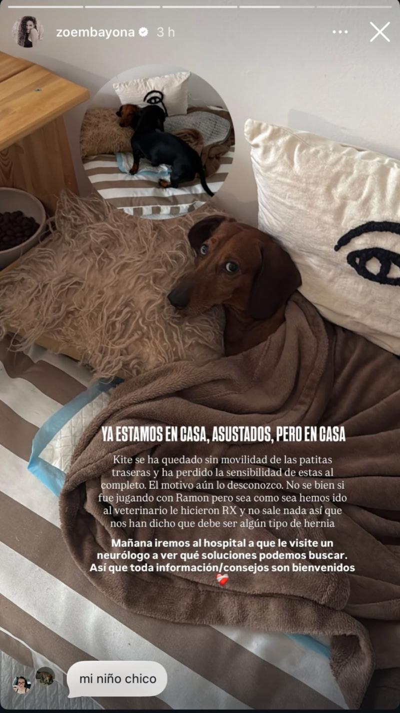 Historia de Zoe Bayona | Instagram