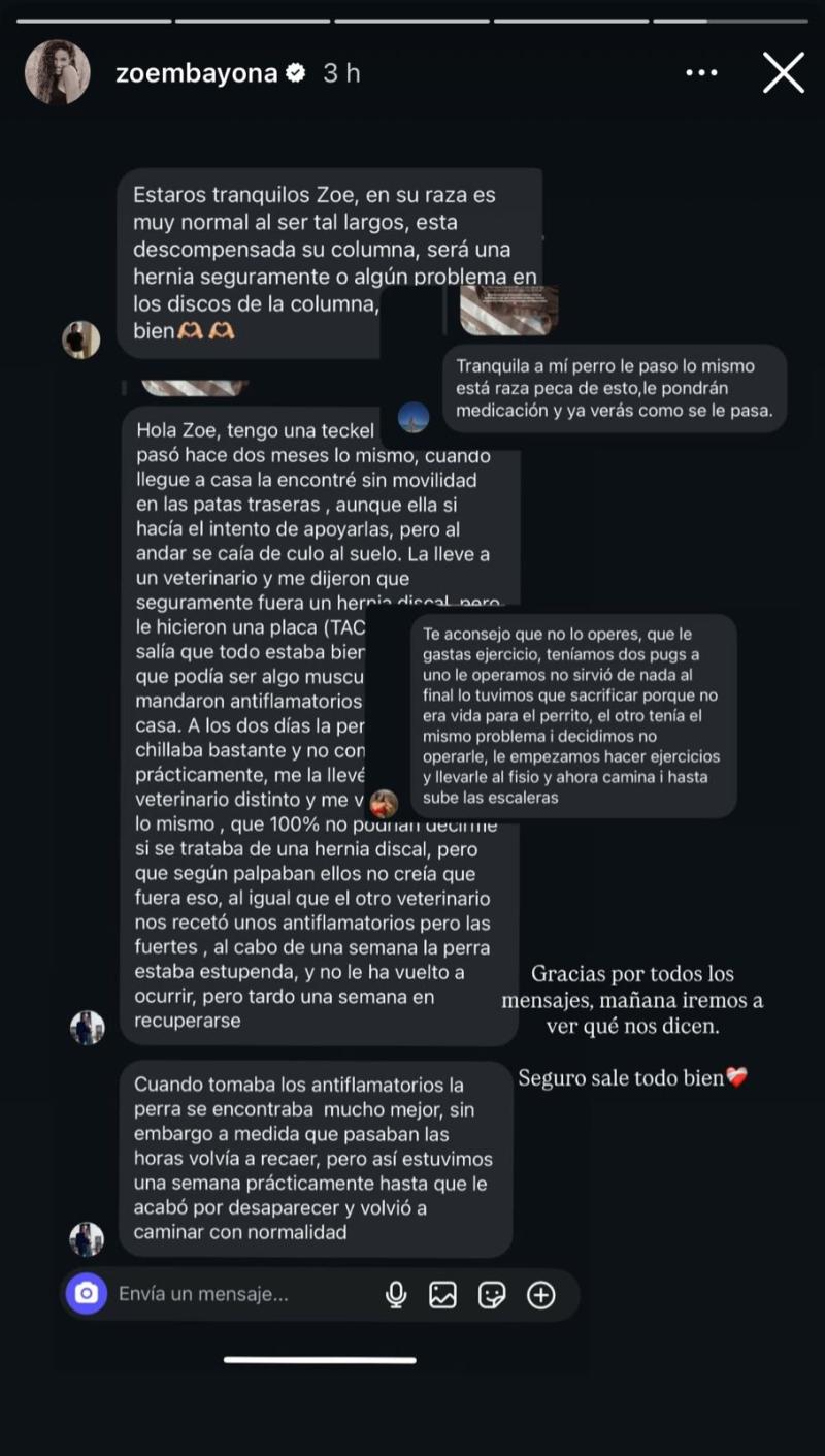 Historia de Zoe Bayona | Instagram