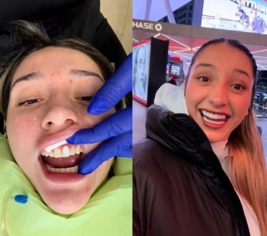 La influenecr muestra las carillas que le regaló su suegra | Instagram