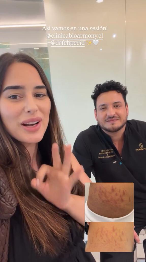 Historia Meli Noto | Instagram