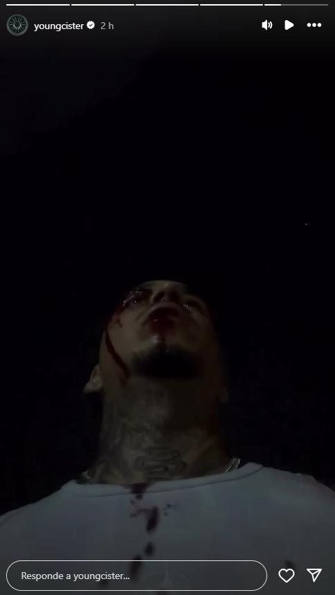 Young Cister aparece en Instagram con rostro ensangrentado | Instagram