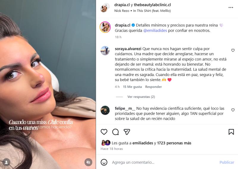Emilia Dides se realizó procedimiento estético - Instagram @drapia.cl