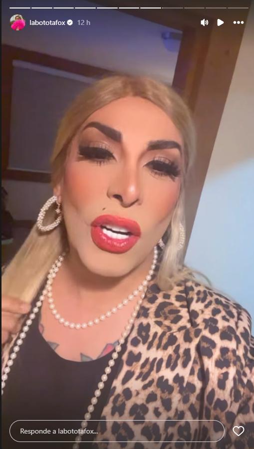 Botota Fox comenta sobre Asskha Sumathra | Viña 2026 | Instagram