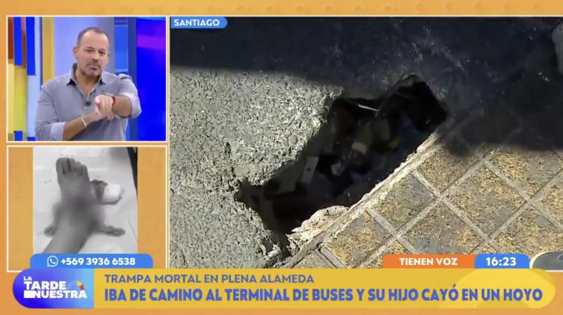 Niño de 4 años cayó a un hoyo y le colocaron 27 puntos.