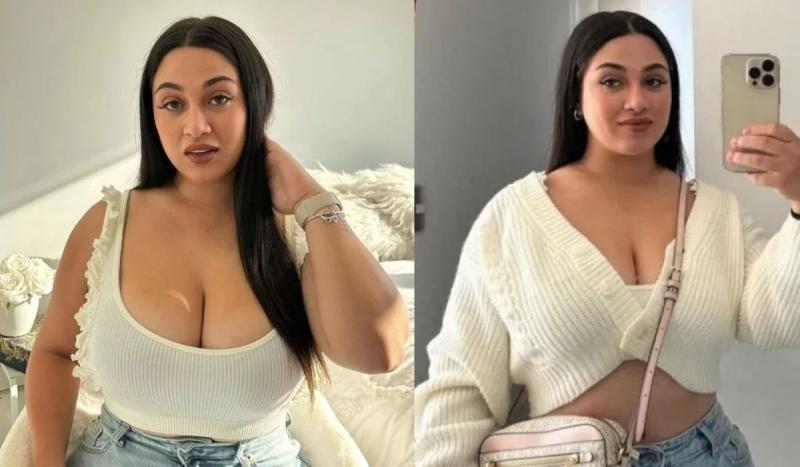 El trasfondo de la historia: su cambio físico y el proceso tras la cirugía | Instagram