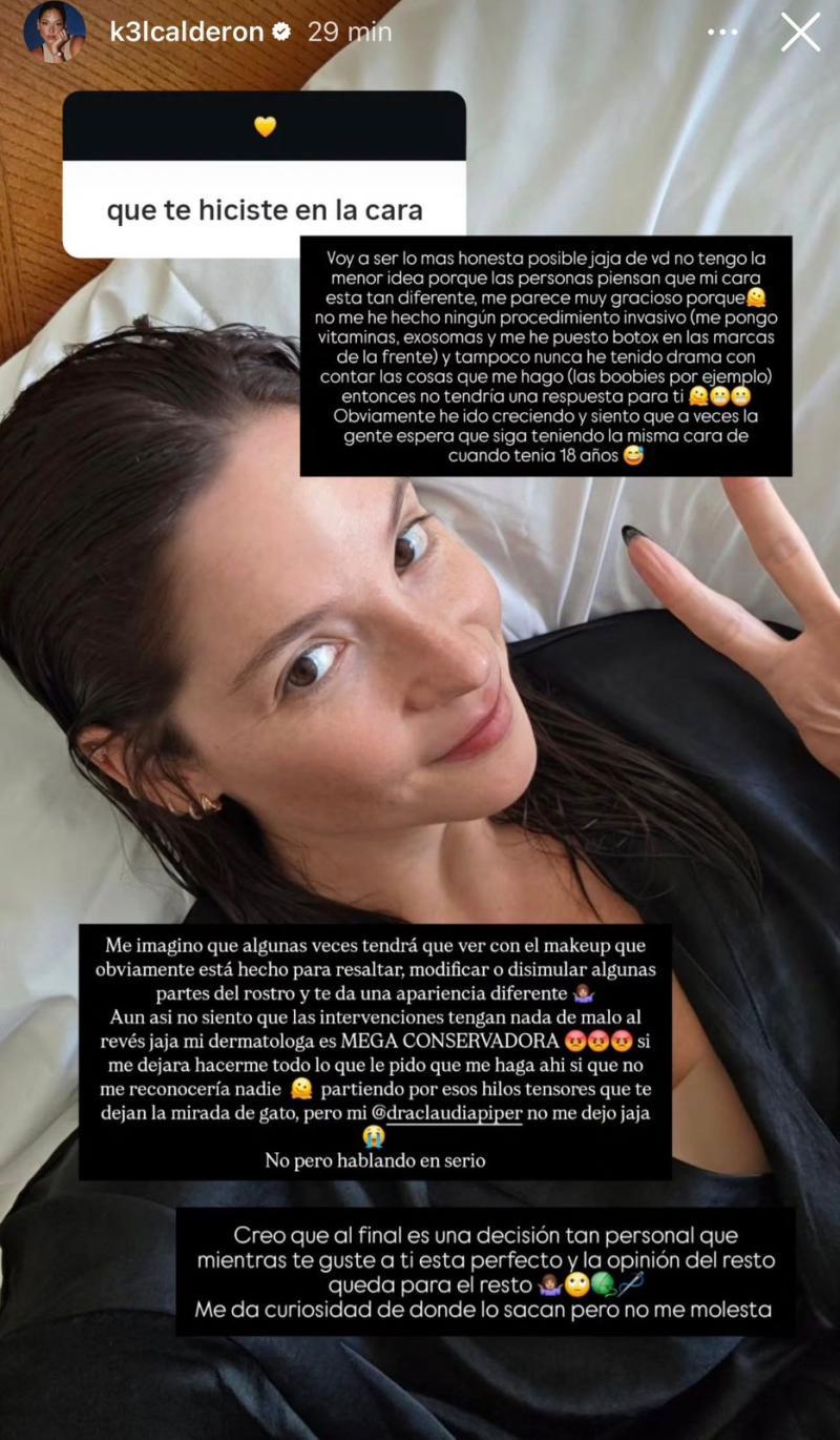 Kel Calderón aborda críticas a su rostro | Instagram