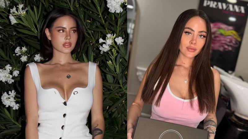 Antes y después de Ignacia Michelson