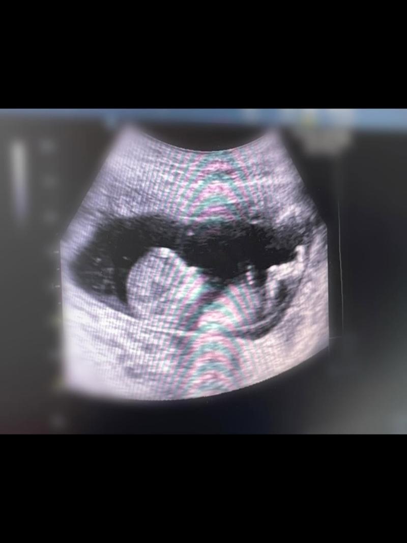 Silvanna Gajardo y Camilo Carmona anuncian que se encuentran esperando un bebé | Instagram