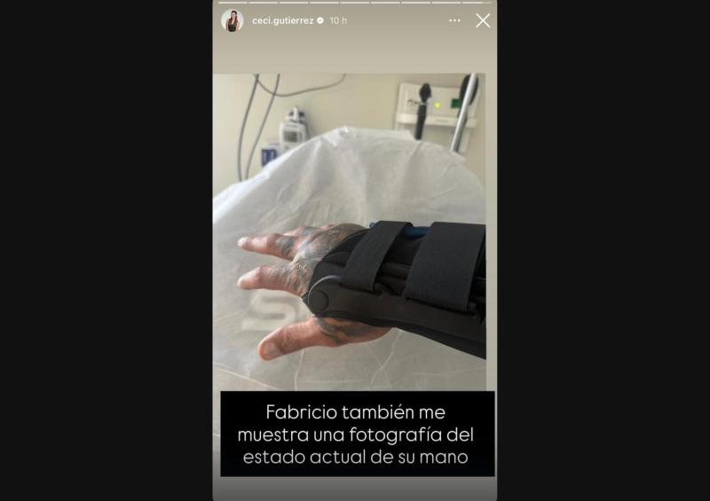 La imagen que compartió Cecilia Gutiérrez de cómo quedó la mano de Fabricio Vasconcelos
