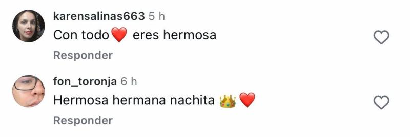 Comentarios sobre post de Ignacia Michelson | Instagram