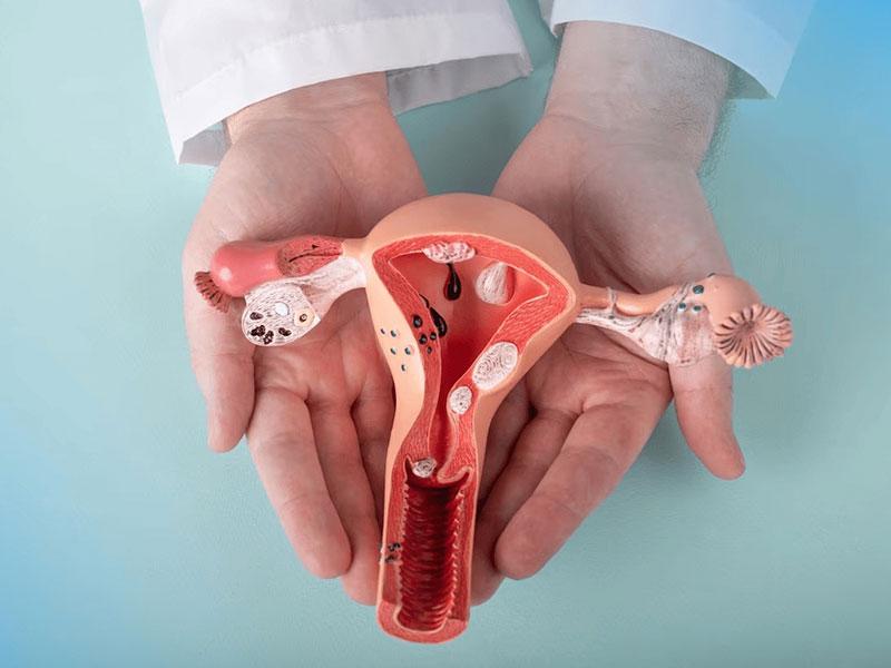 Cáncer de cuello uterino. Créditos: Pexels.