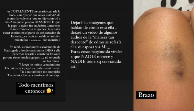 En marzo de 2024 una amiga de Faloon sacó a la luz una serie de audios en los que se daba a conocer los malos tratos del futbolista, previo a la agresión | Instagram