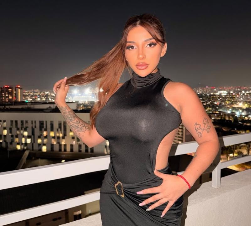 Chilota se sometió a una nueva operación estética - Instagram