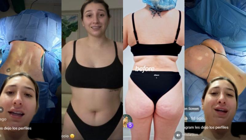 Antes y después de Carlita Inostroza | TikTok