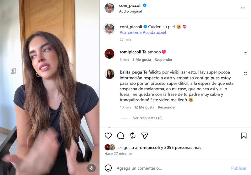 Coni Piccoli releva que fue diagnosticada con cáncer a la piel | Instagram