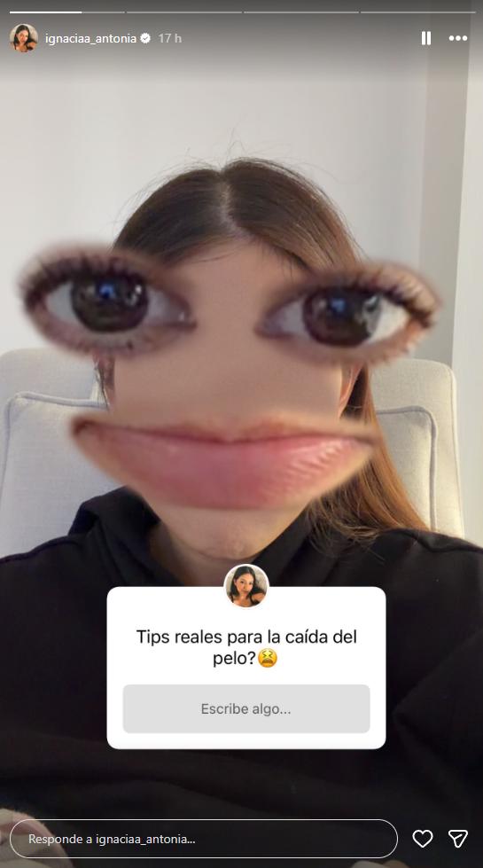Ignacia Antonia revela que está perdiendo pelo | Instgaram