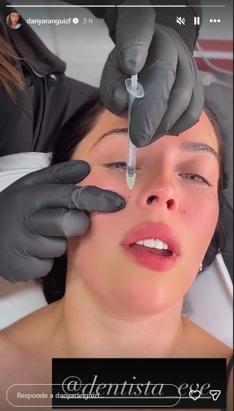 Daniela Aránguiz muestra nueva intervención estética en el rostro | Instagram