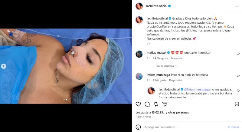 La Chilota se sometió a nuevo procedimiento estético - Instagram
