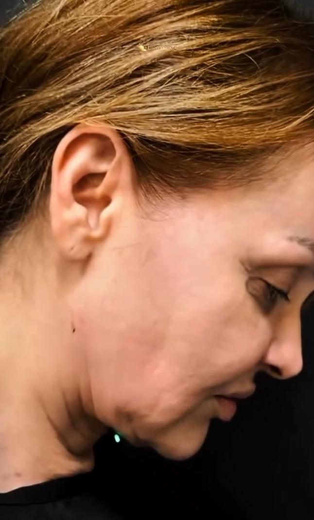 Actriz de La Usurpadora muestra antes de su cirugía | Instagram