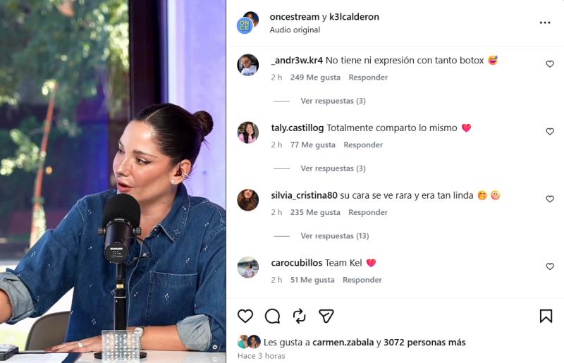 Comentarios que generó el rostro de Kel Calderón - Créditos: Once Stream