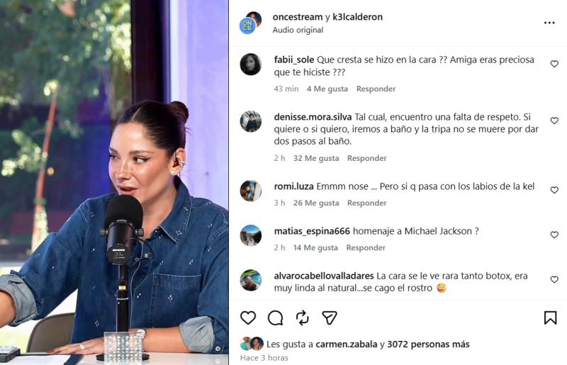 Comentarios que generó el rostro de Kel Calderón - Créditos: Once Stream