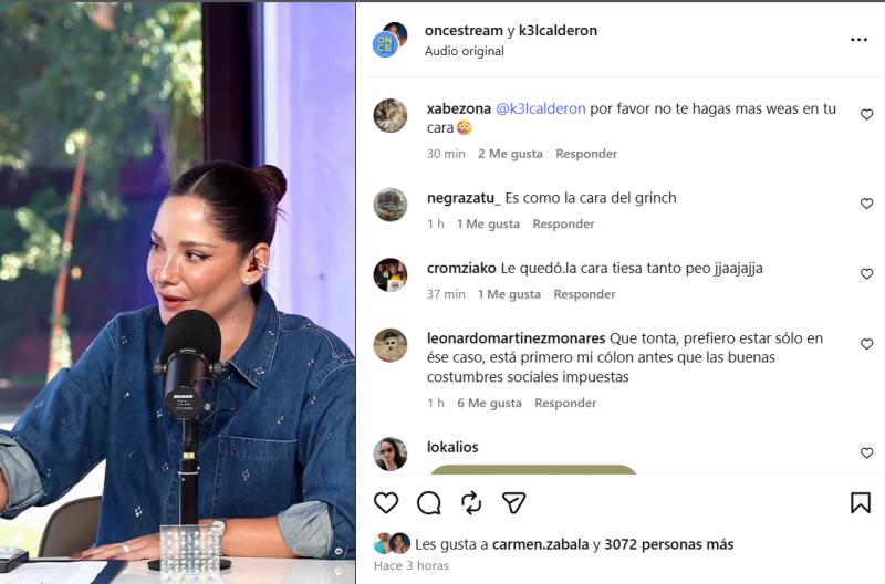 Comentarios que generó el rostro de Kel Calderón - Créditos: Once Stream