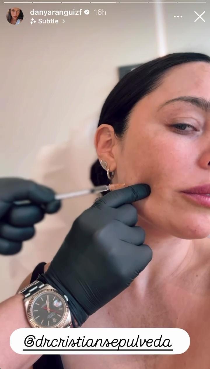 Daniela Aránguiz se realizó otro procedimiento en su rostro en diciembre 2025 | Instagram