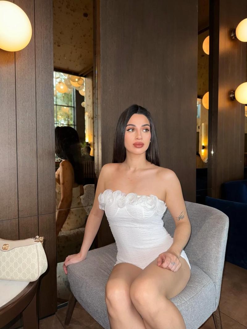 Camila Sepúlveda a dos años de su operación - Instagram