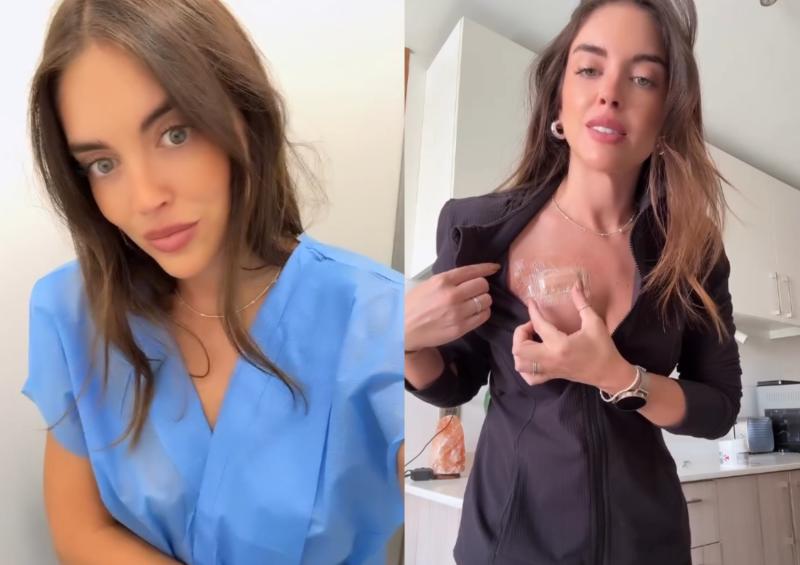 Coni Piccoli mostró el proceso de su cirugía